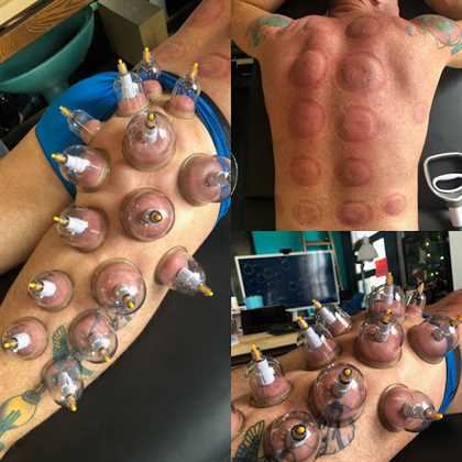 single listing image