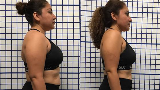 single listing image