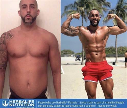 single listing image