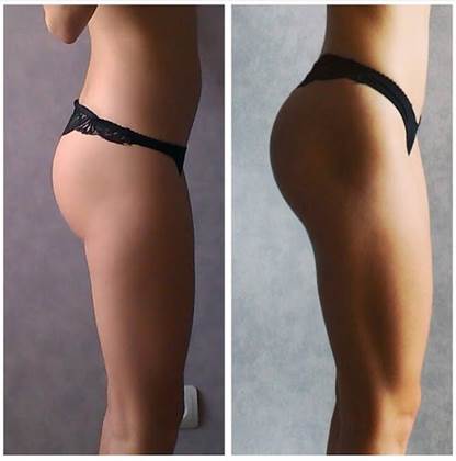 single listing image