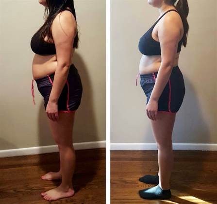 single listing image