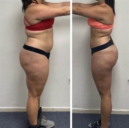 single listing image