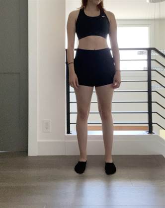 single listing image