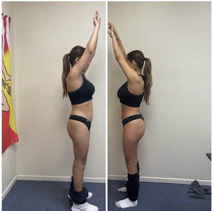 single listing image