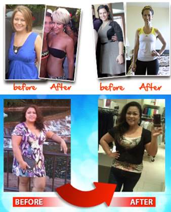 single listing image